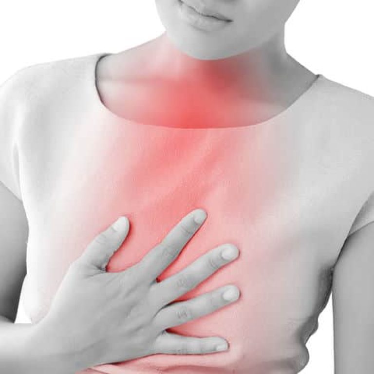 γαστροοισοφαγική παλινδρόμηση